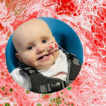 Бебе със симптоми на настинка е диагностицирано с агресивен рак на кръвта