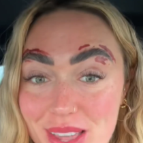 Мартина проклина деня, в който е отишла на кола маска за вежди: „Изгори ми лицето, не мога да се осъзная с дни!“