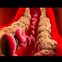 Как да почистите кръвоносните съдове от холестерол по естествен път: 3 вида храни, които работят
