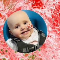 Бебе със симптоми на настинка е диагностицирано с агресивен рак на кръвта