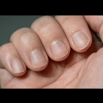 Имате ли тези линии по ноктите си? Трябва да знаете какво всъщност означават!