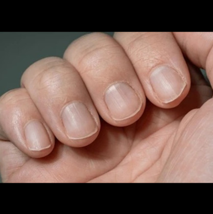 Имате ли тези линии по ноктите си? Трябва да знаете какво всъщност означават!