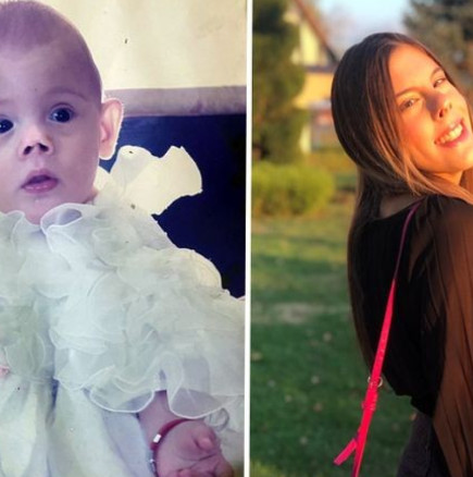 „Борих се и оцелях“: Анастасия е родена с тегло 520 грама, осмивана е от връстниците си, а днес е смело и успешно момиче