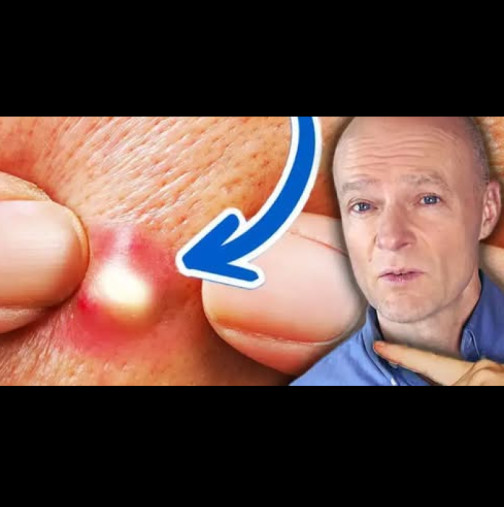 Лекар предупреждава: Това са 10 ЯСНИ признака, че ядете твърде много захар. Малко хора ги забелязват!