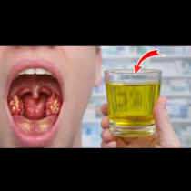 Сварете лук с ТАЗИ съставка и забравете какво са АНГИНА, болки в гърлото и дрезгавост: Изпитана домашна рецепта!