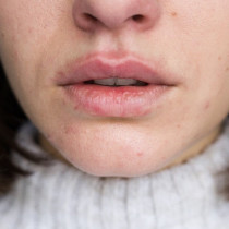 Зимата не може да им направи нищо, дори вятърът има малък шанс: Този старомоден трик защитава устните