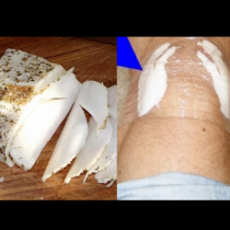 Накисвам сланината в ракия и слагам на коленете: Забравяш и болка, и чудо! Вдига на крака даже куците: