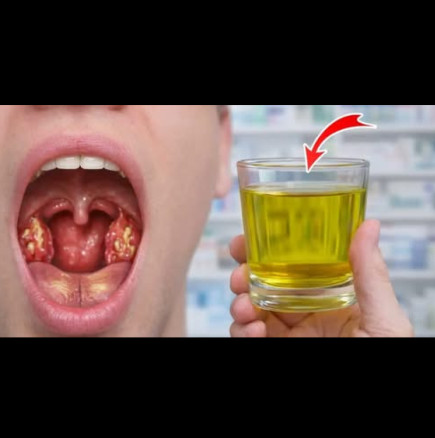 Сварете лук с ТАЗИ съставка и забравете какво са АНГИНА, болки в гърлото и дрезгавост: Изпитана домашна рецепта!