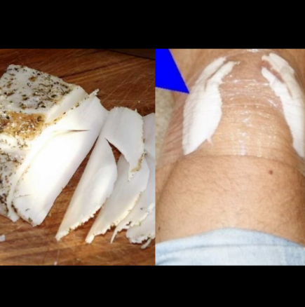 Накисвам сланината в ракия и слагам на коленете: Забравяш и болка, и чудо! Вдига на крака даже куците: