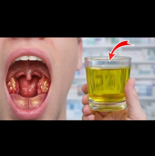 Сварете лук с ТАЗИ съставка и забравете какво са АНГИНА, болки в гърлото и дрезгавост: Изпитана домашна рецепта!