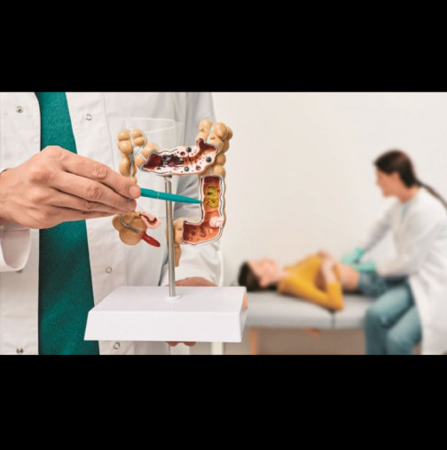 2 ясни симптома на чревна непроходимост в тялото ви: ОПАСНО състояние, което се лекува по следния начин, иначе може да е фатално