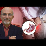 Колко газове на ден са нормални? Професор-гастроентеролог предупреждава: Всичко над ТОВА число може да е предупредителен знак