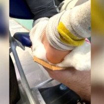 В наша болница обездвижиха счупен крак на дете с кутия за пица