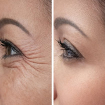 Този евтин домашен мехлем против бръчки чупи всички рекорди. Ще направи лицето ви да изглежда като на момиченце!