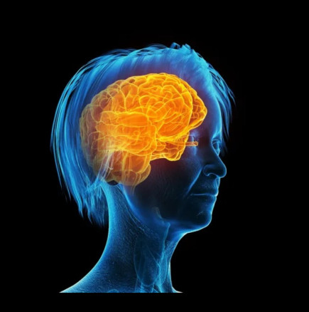 Менопаузата причинява промени в мозъка, подобни на тези при болестта на Алцхаймер: Защо жените по-трудно запомнят и мислят по-бавно