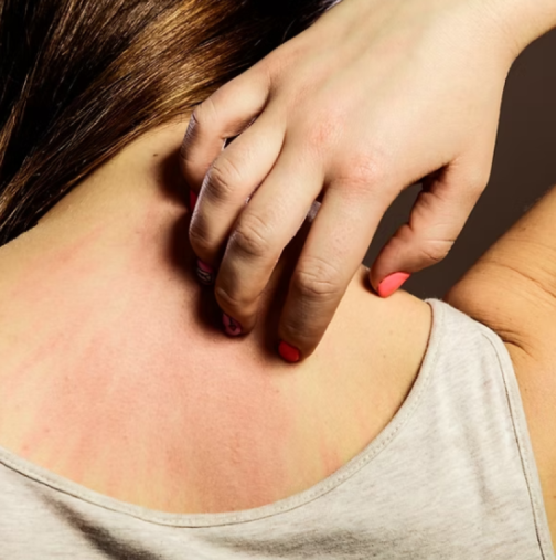 Сърбежът не винаги е безобиден: Той може да е симптом на опасно заболяване-Симптоми на рак на панкреаса, които често се подценяват