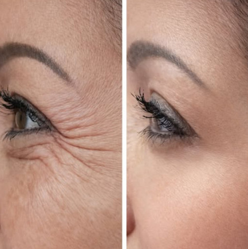 Този евтин домашен мехлем против бръчки чупи всички рекорди. Ще направи лицето ви да изглежда като на момиченце!