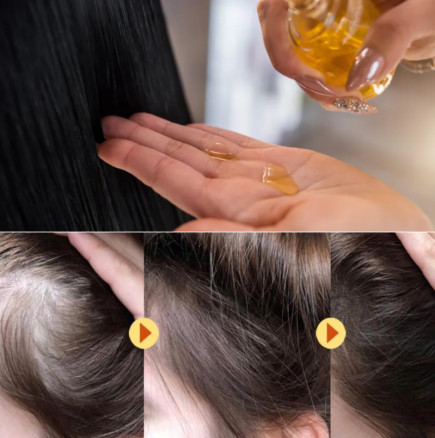 Науката е потвърдила: Това натурално масло увеличава броя на космите с 40%, а резултатите са видими след 8 седмици