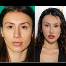 Ето колко са стрували 12-те пластични операции на Санта Китана - тя си разказа всичко!