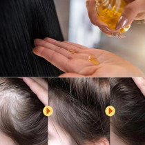 Науката е потвърдила: Това натурално масло увеличава броя на космите с 40%, а резултатите са видими след 8 седмици