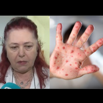 Бяла Слатина под карантина, ситуацията с морбили излиза извън контрол!