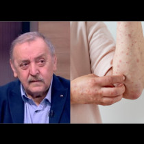 След случаите на морбили при неваксинирани деца проф.Кантарджиев предупреди: Може да има ужасяващи късни усложнения за мозъка