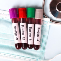 Ако имате тази кръвна група, рискът от инфаркт е минимален