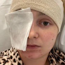 Отишла на рутинен преглед при офталмолог и открили гигантски тумор-Без симптоми-Следват 5 мозъчни операции