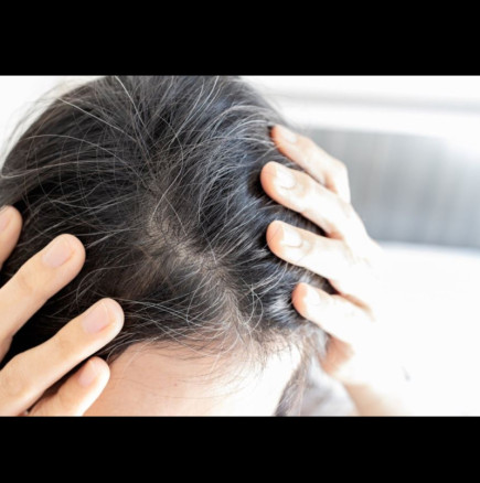 Веднага щом забележите първия сив косъм, използвайте тези естествени съставки: Ще забравите за фризьор, а косата ще бъде по-плътна