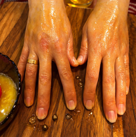 Козметичка съветва всеки, който страда от петна по ръцете: С това чудо ще изчезнат за 24 часа, а кожата ще стане по-красива!