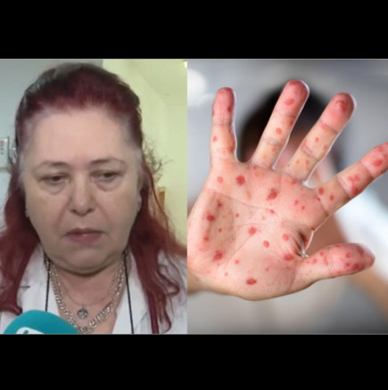 Бяла Слатина под карантина, ситуацията с морбили излиза извън контрол!