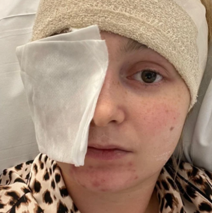 Отишла на рутинен преглед при офталмолог и открили гигантски тумор-Без симптоми-Следват 5 мозъчни операции