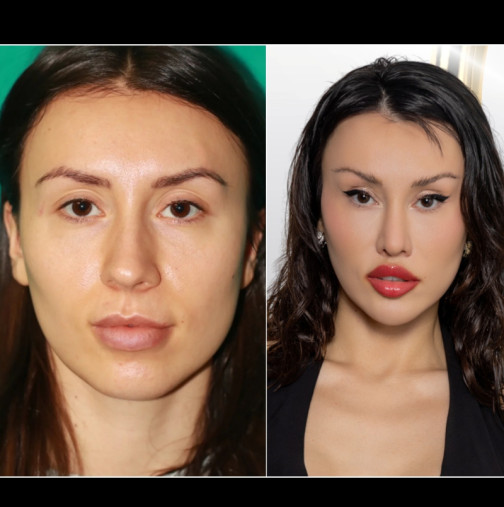 Ето колко са стрували 12-те пластични операции на Санта Китана - тя си разказа всичко!