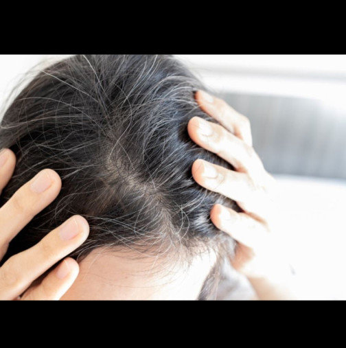 Веднага щом забележите първия сив косъм, използвайте тези естествени съставки: Ще забравите за фризьор, а косата ще бъде по-плътна