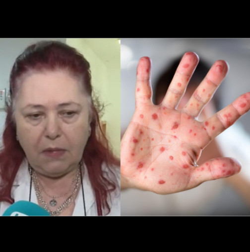 Бяла Слатина под карантина, ситуацията с морбили излиза извън контрол!