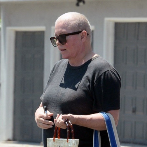 Резултатите показват друг възможен рак: Някога очарователната блондинка е била напълно променена от тежкото заболяване