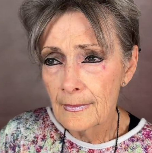 Влизат като 70-годишни баби, излизат като 40-годишни красавици! Пластичен хирург приема само възрастни пациентки и ги променя за 1 нощ: