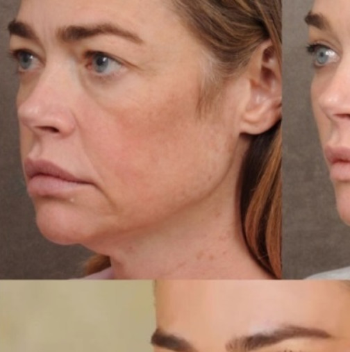 Снимките ПРЕДИ И СЛЕД, които шокираха интернет: Актрисата разкри как изглежда след фейслифт, а реакцията е буреносна!