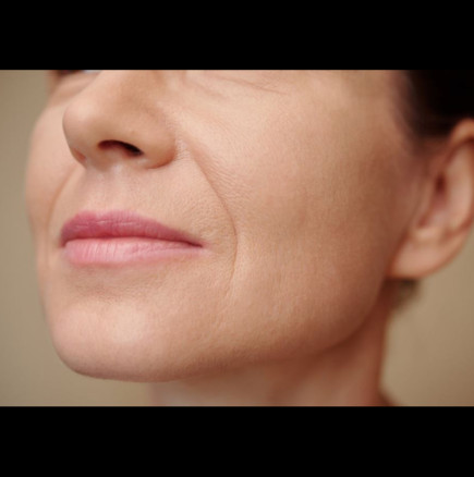 Това са бръчките, които издават възрастта и се появяват първи: Козметик разкрива как да се отървете от тях