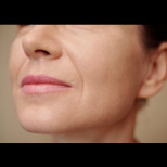 Това са бръчките, които издават възрастта и се появяват първи: Козметик разкрива как да се отървете от тях