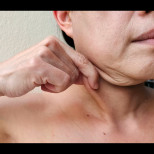 Чували ли сте за ОЗЕМПИК-ЛИЦЕ? Как да се отървете от увиснала кожа след отслабване без пластична операция?