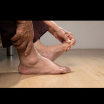 Защо краката ви подуват: Най-добрите съвети на лекарите от Харвард за лечение на отоци