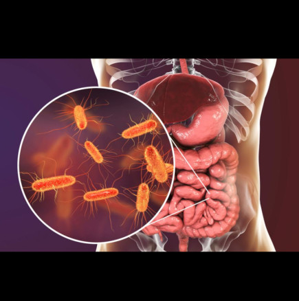 5-те най-добри начина за естествено прочистване на дебелото черво след 50 години: Ще работи като часовник