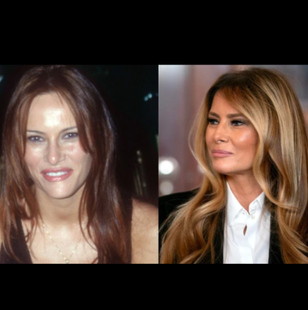 Тайната на обема в косата на Мелания Тръмп: Как постигна гъста и бляскава коса – оказва се изненадващо лесно