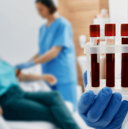 Кръвен тест, който открива риска от инфаркт най-рано: дори при „нормален“ холестерол може да има опасност