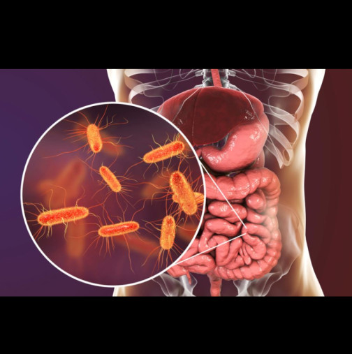 5-те най-добри начина за естествено прочистване на дебелото черво след 50 години: Ще работи като часовник