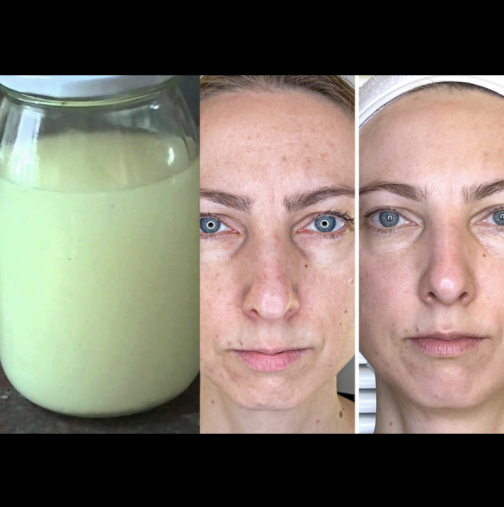 Лекарите го потвърдиха! Това е истински БАЛСАМ на вечната младост. И струва жълти центове!