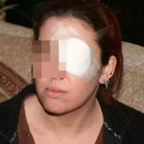 Мъж ослепи жена си с жесток удар, пред очите на майка й