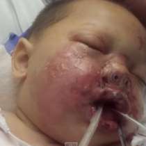 Бебе изпадна в кома, след като отряд за борба с организираната престъпност хвърли бомба в леглото му по погрешка-Видео