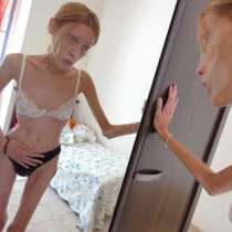 Снимки на манекенките, които починаха от анорексия